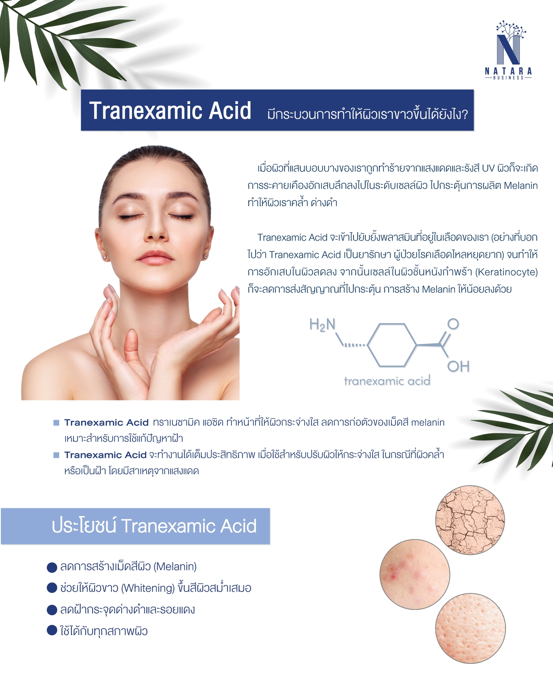 Tranexamic Acid